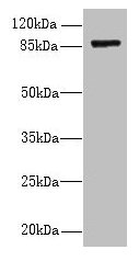 Western blot  | All lanes: FSCB antibody at 1.5µg/ml + Mouse liver tissue  | Secondary  | Goat polyclonal to rabbit IgG at 1/10000 dilution  | Predicted band size: 88 kDa  | Observed band size: 88 kDaRabbit anti-Human FSCB Polyclonal Antibody