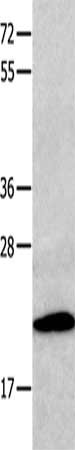 Gel: 10+12%SDS-PAGE, Lysate: 40 μg, Lane: Human fetal kidney tissue, Primary antibody: CMTM3 Antibody(CMTM3 Antibody) at dilution 1/200, Secondary antibody: Goat anti rabbit IgG at 1/8000 dilution, Exposure time: 1 minuteRabbit anti-Human CMTM3 Polyclonal Antibody