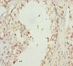 Immunohistochemistry of paraffin-embedded human testis tissue using EFHC1 Antibody at dilution of 1:100Rabbit anti-Human EFHC1 Polyclonal Antibody