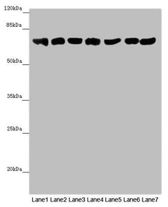 Western blot | All lanes: EFHC1 antibody at 9.9 μg/ml | Lane 1: Mouse large intestine tissue | Lane 2: Mouse stomach tissue | Lane 3: Mouse brain tissue | Lane 4: Mouse kidney tissue | Lane 5: Mouse gonadal tissue | Lane 6: Hela whole cell lysate | Lane 7: 293T whole cell lysate | Secondary | Goat polyclonal to rabbit IgG at 1/10000 dilution | Predicted band size: 74, 32, 73 kDa | Observed band size: 74 kDaRabbit anti-Human EFHC1 Polyclonal Antibody