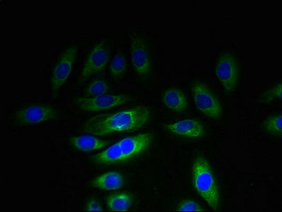 Immunofluorescent analysis of A549 cells using KHDC1 Antibody at dilution of 1:100 and Alexa Fluor 488-congugated AffiniPure Goat Anti-Rabbit IgG(H+L)Rabbit anti-Human KHDC1 Polyclonal Antibody