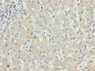 Immunohistochemistry of paraffin-embedded human liver tissue using KHDC1 Antibody at dilution of 1:100Rabbit anti-Human KHDC1 Polyclonal Antibody
