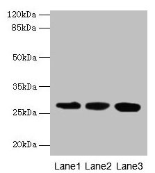 Western blot  | All lanes: KHDC1 antibody at 5µg/ml  | Lane 1: Mouse liver tissue  | Lane 2: Mouse kidney tissue  | Lane 3: Mouse gonadal tissue  | Secondary  | Goat polyclonal to rabbit IgG at 1/10000 dilution  | Predicted band size: 28, 19 kDa  | Observed band size: 28 kDa