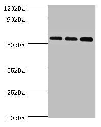Western blot | All lanes: Acyl-coenzyme A synthetase ACSM3, mitochondrial antibody at 10μg/ml | Lane 1: 293T whole cell lysate | Lane 2: Mouse kidney tissue | Lane 3: A431 whole cell lysate | Secondary | Goat polyclonal to rabbit IgG at 1/10000 dilution | Predicted band size: 67, 50 kDa | Observed band size: 67 kDa
