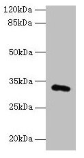 Western blotAll lanes: FAM78A antibody at 0.2µg/ml + HepG2 whole cell lysateSecondaryGoat polyclonal to rabbit IgG at 1/10000 dilutionPredicted band size: 32 kDaObserved band size: 32 kDaRabbit anti-Human FAM78A Polyclonal Antibody
