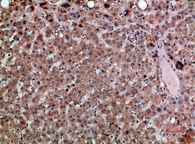 Immunohistochemical analysis of paraffin-embedded human-liver, antibody was diluted at 1:200Rabbit anti-Human CXCL12 Polyclonal Antibody