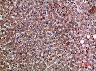 Immunohistochemical analysis of paraffin-embedded human-liver, antibody was diluted at 1:200Rabbit anti-Human CXCL12 Polyclonal Antibody