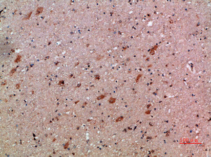 Immunohistochemical analysis of paraffin-embedded human-brain, antibody was diluted at 1:200Rabbit anti-Human CXCL12 Polyclonal Antibody