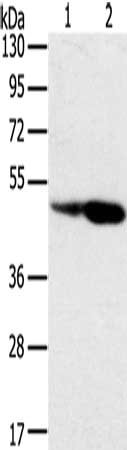 Gel: 8%SDS-PAGE, Lysate: 40 μg, Lane 1-2: Hepg2 cells, hela cells, Primary antibody: SNX8 Antibody(SNX8 Antibody) at dilution 1/400, Secondary antibody: Goat anti rabbit IgG at 1/8000 dilution, Exposure time: 1 minuteRabbit anti-Human SNX8 Polyclonal Antibody