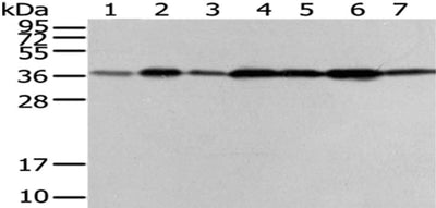 Gel: 12%SDS-PAGE,Lysate: 40 μg,Lane 1-7: Human placenta tissue, PC3 cells, Human fetal liver tissue, HepG2 cells, Hela cells, A431 cells, 293T cells,Primary antibody: VPS26A Antibody(VPS26A Antibody) at dilution 1/200 dilution,Secondary antibody: Goat anti rabbit IgG at 1/8000 dilution,Exposure time: 40 secondsRabbit anti-Human VPS26A Polyclonal Antibody