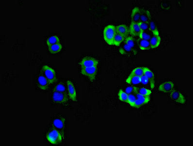 Immunofluorescent analysis of PC-3 cells using MFSD14B Antibody at dilution of 1:100 and Alexa Fluor 488-congugated AffiniPure Goat Anti-Rabbit IgG(H+L)