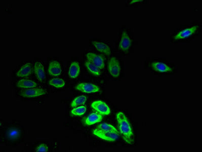 Immunofluorescent analysis of HepG2 cells using MFSD14B Antibody at dilution of 1:100 and Alexa Fluor 488-congugated AffiniPure Goat Anti-Rabbit IgG(H+L)