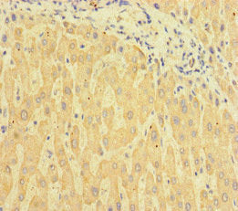 Immunohistochemistry of paraffin-embedded human liver tissue using the antibody at dilution of 1:100Rabbit anti-Human TSBP1 Polyclonal Antibody