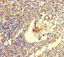 Immunohistochemistry of paraffin-embedded human spleen tissue using TSBP1 Antibody at dilution of 1:100Rabbit anti-Human TSBP1 Polyclonal Antibody