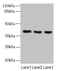 Western blot  | All lanes: C9orf64 antibody at 1µg/ml  | Lane 1: Hela whole cell lysate  | Lane 2: K562 whole cell lysate  | Lane 3: HepG2 whole cell lysate  | Secondary  | Goat polyclonal to rabbit IgG at 1/10000 dilution  | Predicted band size: 40 kDa  | Observed band size: 40 kDa