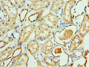 Immunohistochemistry of paraffin-embedded human kidney tissue using ATAD3B Antibody at dilution of 1:100Rabbit anti-Human ATAD3B Polyclonal Antibody