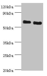 Western blot | All lanes: ATAD3B antibody at 2μg/ml | Lane 1: Jurkat whole cell lysate | Lane 2: Hela whole cell lysate | Secondary | Goat polyclonal to rabbit IgG at 1/10000 dilution | Predicted band size: 73, 20, 68 kDa | Observed band size: 73 kDaRabbit anti-Human ATAD3B Polyclonal Antibody