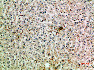Immunohistochemical analysis of paraffin-embedded human-liver, antibody was diluted at 1:200Rabbit anti-Human TNIP2 Polyclonal Antibody