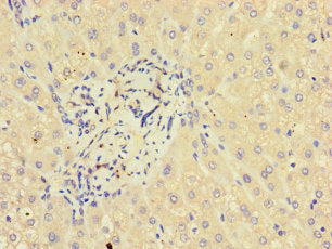 Immunohistochemistry of paraffin-embedded human liver tissue using GLT8D1 Antibody at dilution of 1:100Rabbit anti-Human GLT8D1 Polyclonal Antibody