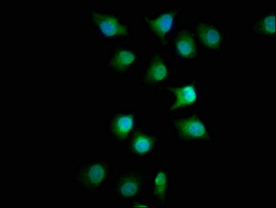 Immunofluorescence staining of A549 cells with FMN1 Antibody at 1:100, counter-stained with DAPI. The cells were fixed in 4% formaldehyde, permeabilized using 0.2% Triton X-100 and blocked in 10% normal Goat Serum. The cells were then incubated with the antibody overnight at 4°C. The secondary antibody was Alexa Fluor 488-congugated AffiniPure Goat Anti-Rabbit IgG(H+L).Rabbit anti-Human FMN1 Polyclonal Antibody