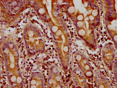 IHC image of FMN1 Antibody diluted at 1:300 and staining in paraffin-embedded human small intestine tissue performed on a Leica BondTM system. After dewaxing and hydration, antigen retrieval was mediated by high pressure in a citrate buffer (pH 6.0). Section was blocked with 10% normal goat serum 30min at RT. Then primary antibody (1% BSA) was incubated at 4°C overnight. The primary is detected by a biotinylated secondary antibody and visualized using an HRP conjugated SP system.Rabbit anti-Human FMN1 Polyclonal Antibody