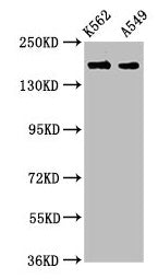 Western Blot  | Positive WB detected in: K562 whole cell lysate, A549 whole cell lysate  | All lanes: FMN1 antibody at 3.9µg/ml  | Secondary  | Goat polyclonal to rabbit IgG at 1/50000 dilution  | Predicted band size: 158, 72, 54, 133 kDa  | Observed band size: 158 kDaRabbit anti-Human FMN1 Polyclonal Antibody