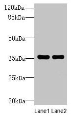 Western blot  | All lanes: NAIF1 antibody at 6µg/ml  | Lane 1: Mouse brain tissue  | Lane 2: Mouse heart tissue  | Secondary  | Goat polyclonal to rabbit IgG at 1/10000 dilution  | Predicted band size: 36, 18 kDa  | Observed band size: 36 kDaRabbit anti-Human NAIF1 Polyclonal Antibody