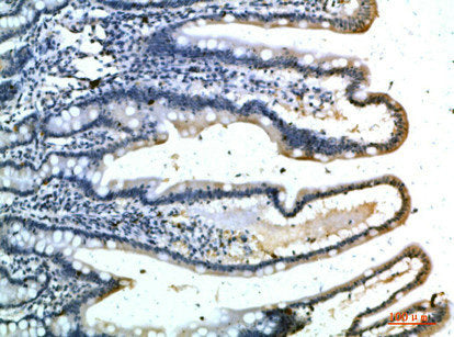 Immunohistochemical analysis of paraffin-embedded human-colon, antibody was diluted at 1:200Rabbit anti-Human SELE Polyclonal Antibody
