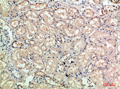 Immunohistochemical analysis of paraffin-embedded human-kidney, antibody was diluted at 1:200Rabbit anti-Human SELE Polyclonal Antibody
