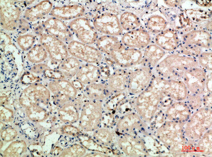 Immunohistochemical analysis of paraffin-embedded human-kidney, antibody was diluted at 1:200Rabbit anti-Human SELE Polyclonal Antibody