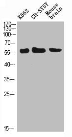 Western Blot analysis of K562 SH-SY5Y mouse-brain cells using E-Selectin Polyclonal Antibody diluted at 1:500. Secondary antibody  was diluted at 1:20000Rabbit anti-Human SELE Polyclonal Antibody