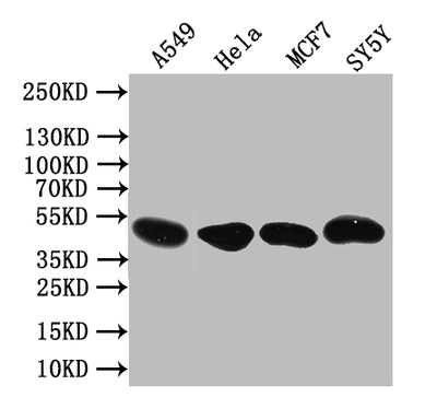 Western Blot Positive WB detected in: A549 whole cell lysate,Hela whole cell lysate,MCF7 whole cell lysate,SY5Y whole cell lysate All lanes: PLEKHS1 antibody at 1:1000 Secondary Goat polyclonal to rabbit IgG at 1/50000 dilution Predicted band size: 52 kDa Observed band size: 52 kDaRabbit anti-Human PLEKHS1 Polyclonal Antibody
