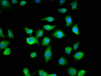 Immunofluorescence staining of A549 cells with MYBPC1 Antibody at 1:200, counter-stained with DAPI. The cells were fixed in 4% formaldehyde, permeabilized using 0.2% Triton X-100 and blocked in 10% normal Goat Serum. The cells were then incubated with the antibody overnight at 4°C. The secondary antibody was Alexa Fluor 488-congugated AffiniPure Goat Anti-Rabbit IgG(H+L).Rabbit anti-Human MYBPC1 Polyclonal Antibody