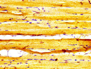IHC image of the antibody diluted at 1:600 and staining in paraffin-embedded human skeletal muscle tissue performed on a Leica BondTM system. After dewaxing and hydration, antigen retrieval was mediated by high pressure in a citrate buffer (pH 6.0). Section was blocked with 10% normal goat serum 30min at RT. Then primary antibody (1% BSA) was incubated at 4°C overnight. The primary is detected by a biotinylated secondary antibody and visualized using an HRP conjugated SP system.Rabbit anti-Human MYBPC1 Polyclonal Antibody