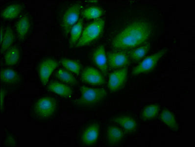 Immunofluorescence staining of A549 cells with RNF213 Antibody at 1:266, counter-stained with DAPI. The cells were fixed in 4% formaldehyde, permeabilized using 0.2% Triton X-100 and blocked in 10% normal Goat Serum. The cells were then incubated with the antibody overnight at 4°C. The secondary antibody was Alexa Fluor 488-congugated AffiniPure Goat Anti-Rabbit IgG(H+L).Rabbit anti-Human RNF213 Polyclonal Antibody