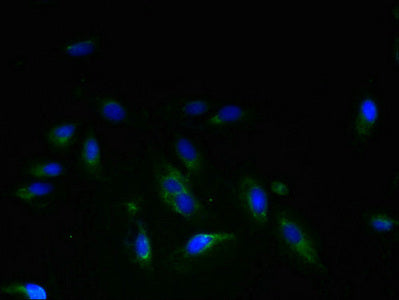 Immunofluorescent analysis of Hela cells using STEAP3 Antibody at dilution of 1:100 and Alexa Fluor 488-congugated AffiniPure Goat Anti-Rabbit IgG(H+L)Rabbit anti-Human STEAP3 Polyclonal Antibody