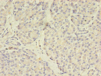 Immunohistochemistry of paraffin-embedded human pancreatic tissue using STEAP3 Antibody at dilution of 1:100Rabbit anti-Human STEAP3 Polyclonal Antibody