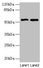 Western blot  | All lanes: STEAP3 antibody at 24µg/ml  | Lane 1: HepG2 whole cell lysate  | Lane 2: Hela whole cell lysate  | Secondary  | Goat polyclonal to rabbit IgG at 1/10000 dilution  | Predicted band size: 55, 56, 51 kDa  | Observed band size: 55 kDaRabbit anti-Human STEAP3 Polyclonal Antibody