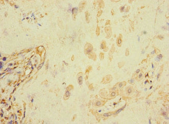 Immunohistochemistry of paraffin-embedded human placenta tissue using FCRL6 Antibody at dilution of 1:100Rabbit anti-Human FCRL6 Polyclonal Antibody