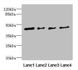 Western blot | All lanes: FCRL6 antibody at 1.29μg/ml | Lane 1: Hela whole cell lysate | Lane 2: A549 whole cell lysate | Lane 3: Jurkat whole cell lysate | Lane 4: HepG2 whole cell lysate | Secondary | Goat polyclonal to rabbit IgG at 1/10000 dilution | Predicted band size: 48, 46, 44, 35 kDa | Observed band size: 48 kDaRabbit anti-Human FCRL6 Polyclonal Antibody