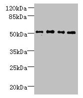 Western blot  | All lanes: TTC38 antibody at 1.5µg/ml  | Lane 1: U251 whole cell lysate  | Lane 2: Mouse liver tissue  | Lane 3: HepG2 whole cell lysate  | Lane 4: K562 whole cell lysate  | Secondary  | Goat polyclonal to rabbit IgG at 1/10000 dilution  | Predicted band size: 53 kDa  | Observed band size: 53 kDaRabbit anti-Human TTC38 Polyclonal Antibody