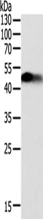 Gel: 12%SDS-PAGE, Lysate: 40 μg, Lane: Human fetal kidney tissue, Primary antibody: SLC12A1 Antibody(SLC12A1 Antibody) at dilution 1/200, Secondary antibody: Goat anti rabbit IgG at 1/8000 dilution, Exposure time: 1 minuteRabbit anti-Human SLC12A1 Polyclonal Antibody