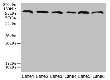 Western blot  | All lanes: CATSPERE antibody at 6µg/ml  | Lane 1: U87 whole cell lysate  | Lane 2: HepG2 whole cell lysate  | Lane 3: A549 whole cell lysate  | Lane 4: Mouse lung tissue  | Lane 5: Mouse liver tissue  | Lane 6: PC-3 whole cell lysate  | Secondary  | Goat polyclonal to rabbit IgG at 1/10000 dilution  | Predicted band size: 110, 96, 93 kDa  | Observed band size: 110 kDa