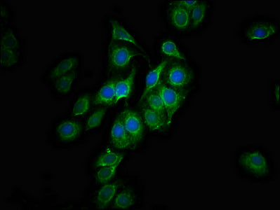 Immunofluorescence staining of HepG2 cells with CPTP Antibody at 1:100, counter-stained with DAPI. The cells were fixed in 4% formaldehyde, permeabilized using 0.2% Triton X-100 and blocked in 10% normal Goat Serum. The cells were then incubated with the antibody overnight at 4°C. The secondary antibody was Alexa Fluor 488-congugated AffiniPure Goat Anti-Rabbit IgG(H+L).Rabbit anti-Human CPTP Polyclonal Antibody