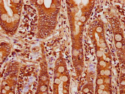 IHC image of CPTP Antibody diluted at 1:300 and staining in paraffin-embedded human small intestine tissue performed on a Leica BondTM system. After dewaxing and hydration, antigen retrieval was mediated by high pressure in a citrate buffer (pH 6.0). Section was blocked with 10% normal goat serum 30min at RT. Then primary antibody (1% BSA) was incubated at 4°C overnight. The primary is detected by a biotinylated secondary antibody and visualized using an HRP conjugated SP system.Rabbit anti-Human CPTP Polyclonal Antibody
