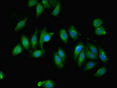 Immunofluorescent analysis of A549 cells using C12orf60 Antibody at dilution of 1:100 and Alexa Fluor 488-congugated AffiniPure Goat Anti-Rabbit IgG(H+L)