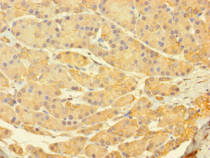 Immunohistochemistry of paraffin-embedded human pancreatic tissue using C12orf60 Antibody at dilution of 1:100
