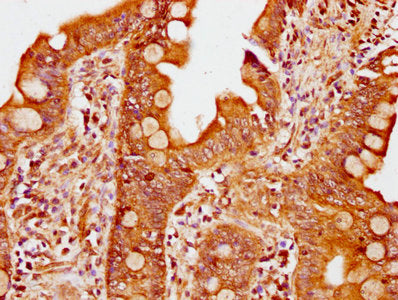 IHC image of PIK3R6 Antibody diluted at 1:400 and staining in paraffin-embedded human small intestine tissue performed on a Leica BondTM system. After dewaxing and hydration, antigen retrieval was mediated by high pressure in a citrate buffer (pH 6.0). Section was blocked with 10% normal goat serum 30min at RT. Then primary antibody (1% BSA) was incubated at 4°C overnight. The primary is detected by a biotinylated secondary antibody and visualized using an HRP conjugated SP system.Rabbit anti-Human PIK3R6 Polyclonal Antibody