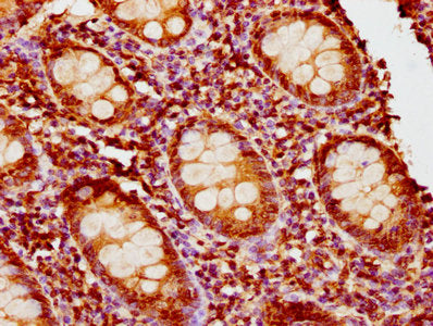 IHC image of PIK3R6 Antibody diluted at 1:400 and staining in paraffin-embedded human appendix tissue performed on a Leica BondTM system. After dewaxing and hydration, antigen retrieval was mediated by high pressure in a citrate buffer (pH 6.0). Section was blocked with 10% normal goat serum 30min at RT. Then primary antibody (1% BSA) was incubated at 4°C overnight. The primary is detected by a biotinylated secondary antibody and visualized using an HRP conjugated SP system.Rabbit anti-Human PIK3R6 Polyclonal Antibody