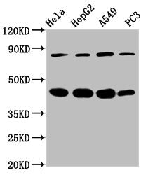 Western Blot  | Positive WB detected in: Hela whole cell lysate, HepG2 whole cell lysate, A549 whole cell lysate, PC-3 whole cell lysate  | All lanes: PIK3R6 antibody at 3.4µg/ml  | Secondary  | Goat polyclonal to rabbit IgG at 1/50000 dilution  | Predicted band size: 85 kDa  | Observed band size: 85 kDaRabbit anti-Human PIK3R6 Polyclonal Antibody